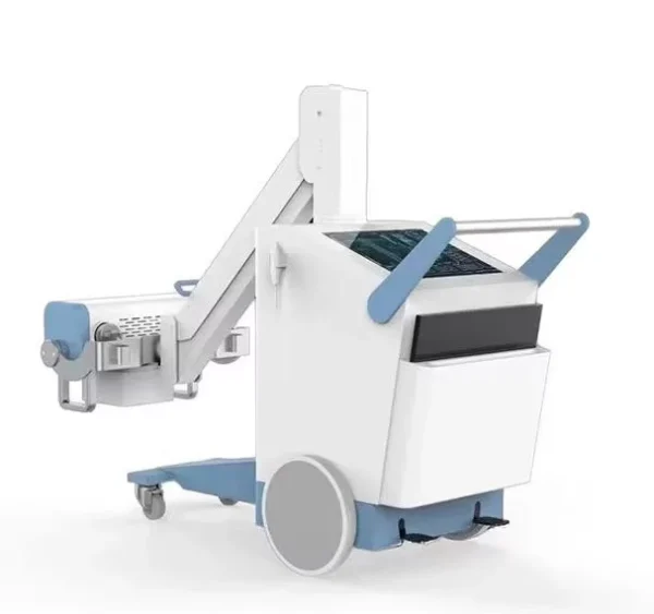 Digitales Röntgen mit dem mobilem digitalem Röntgensystem GX25